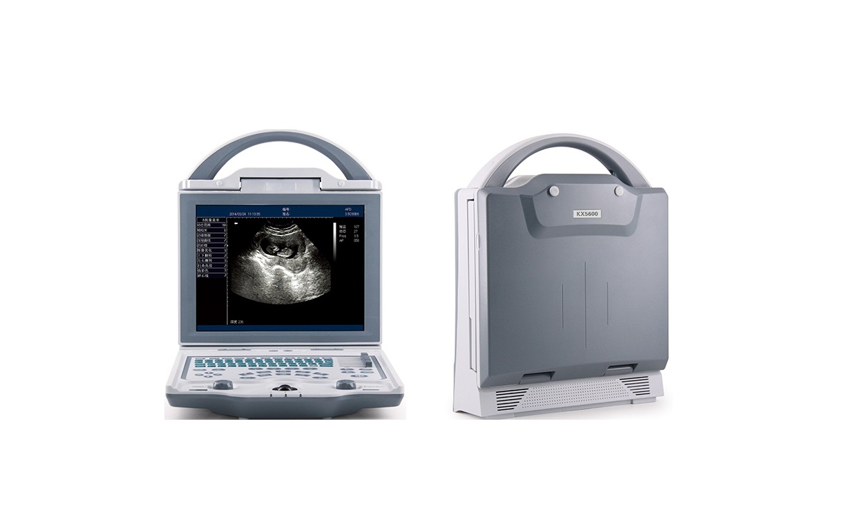 rechargeable human ultrasound scanner -kx5600 - Image 2
