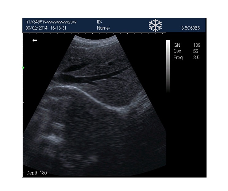 rechargeable human ultrasound scanner -kx5600 - Image 5