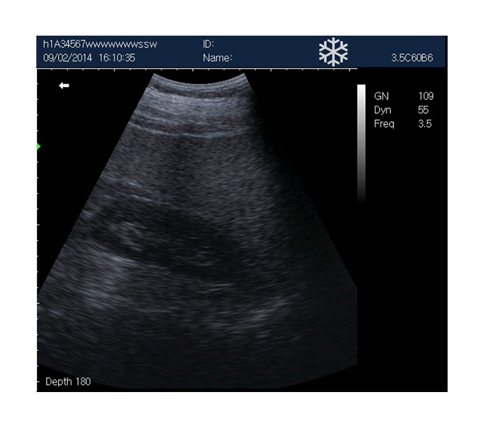 rechargeable human ultrasound scanner -kx5600 - Image 6