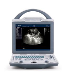 rechargeable human ultrasound scanner -kx5600