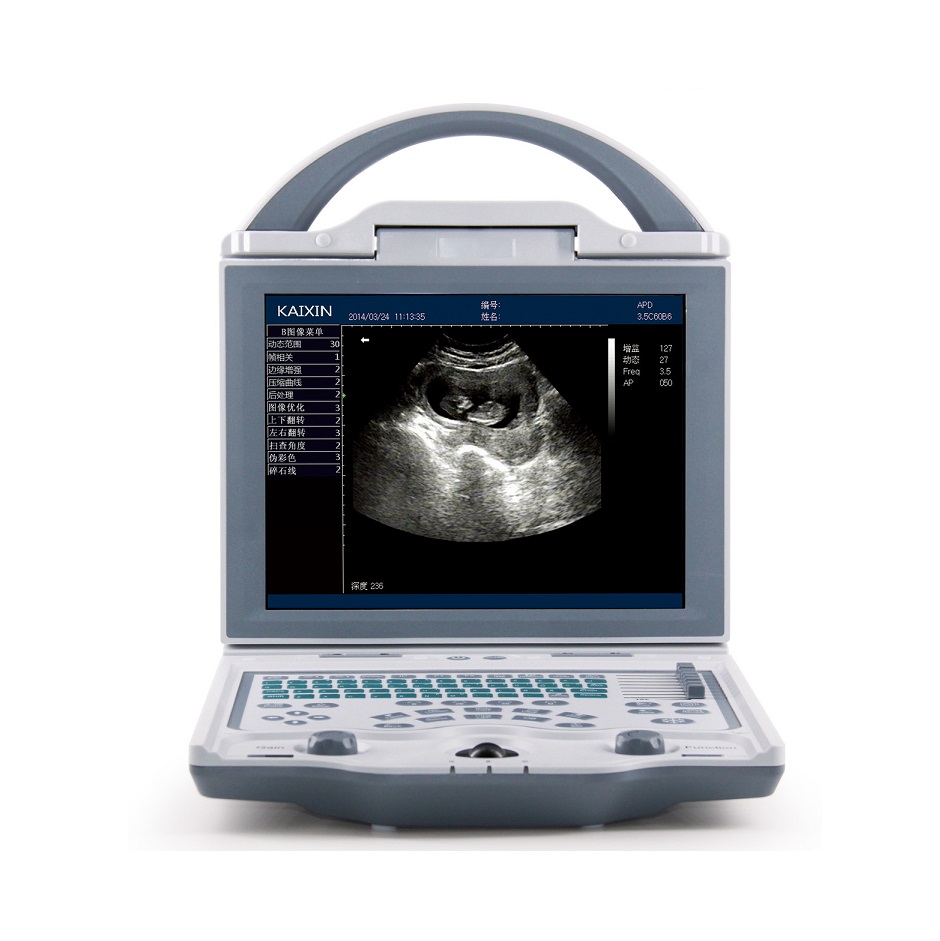rechargeable human ultrasound scanner -kx5600