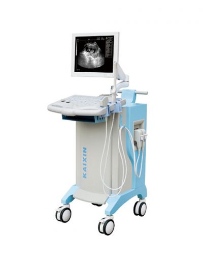 kx2802-trolley full digital human b mode ultrasonic diagnostic instruments