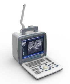Alternative view of portable led screen ultrasound