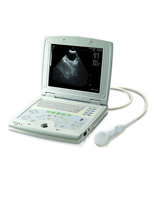 KX5000 Laptop Ultrasound