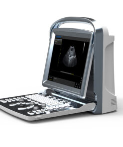 Alternative view of CHISON ECO 1