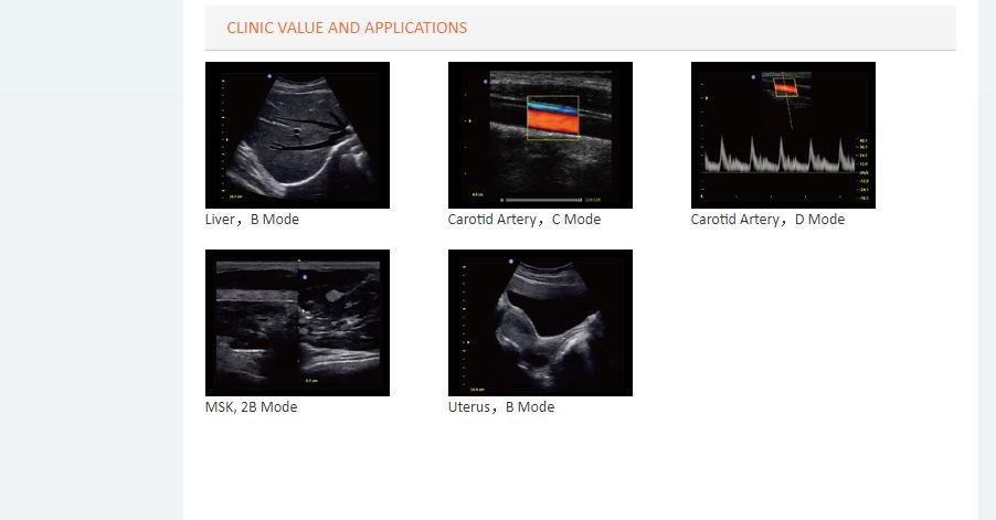 Cardiovascular Color Doppler ECO 5 - Image 7