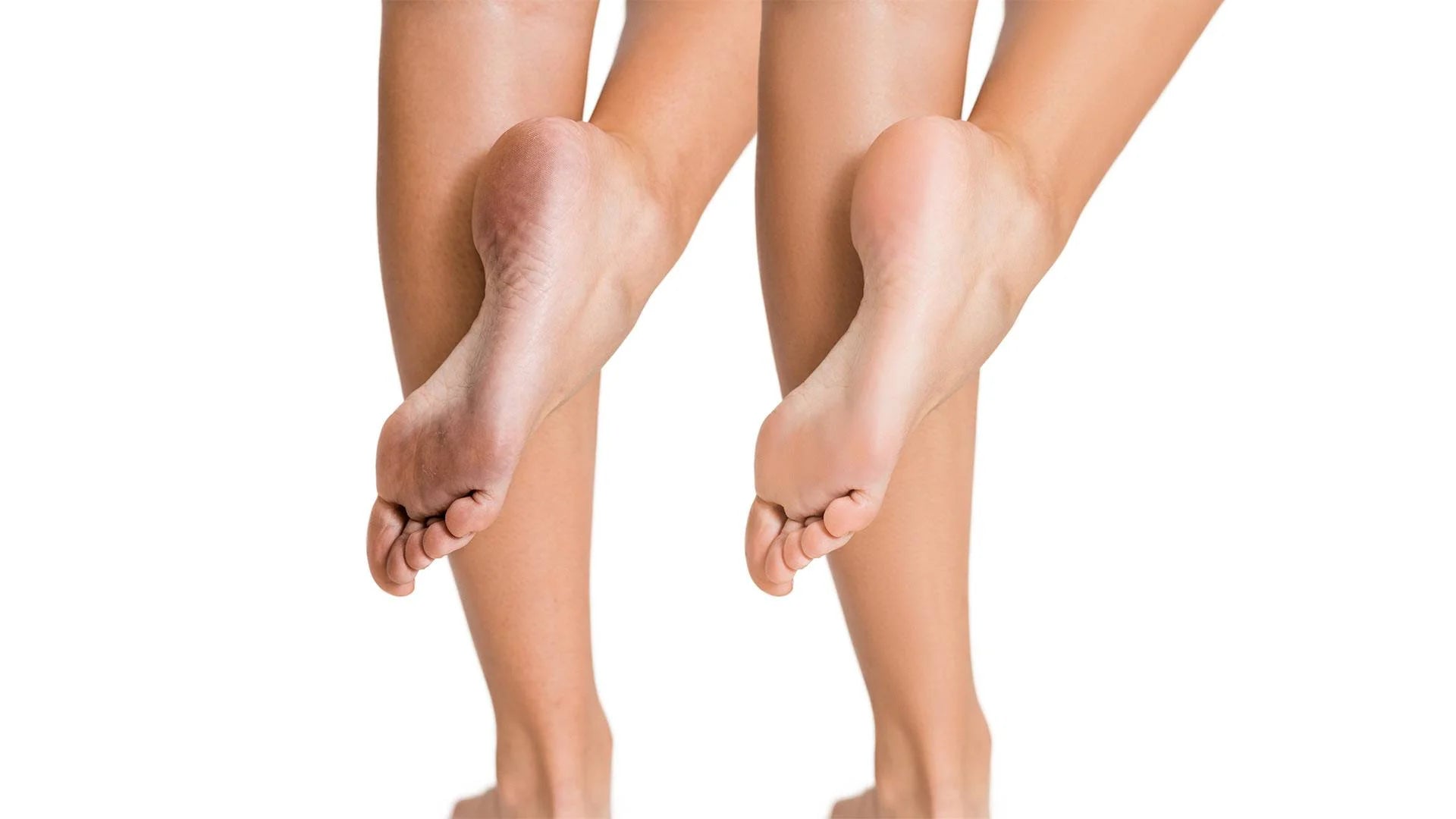Import placeholder for 30165 - Image 3